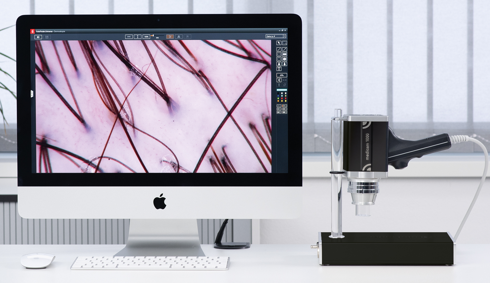 FotoFinder Docking Station_Tricho